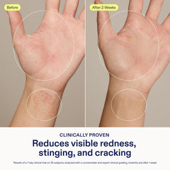 Skinfix Hand Relief Cream jar closeup with non greasy texture