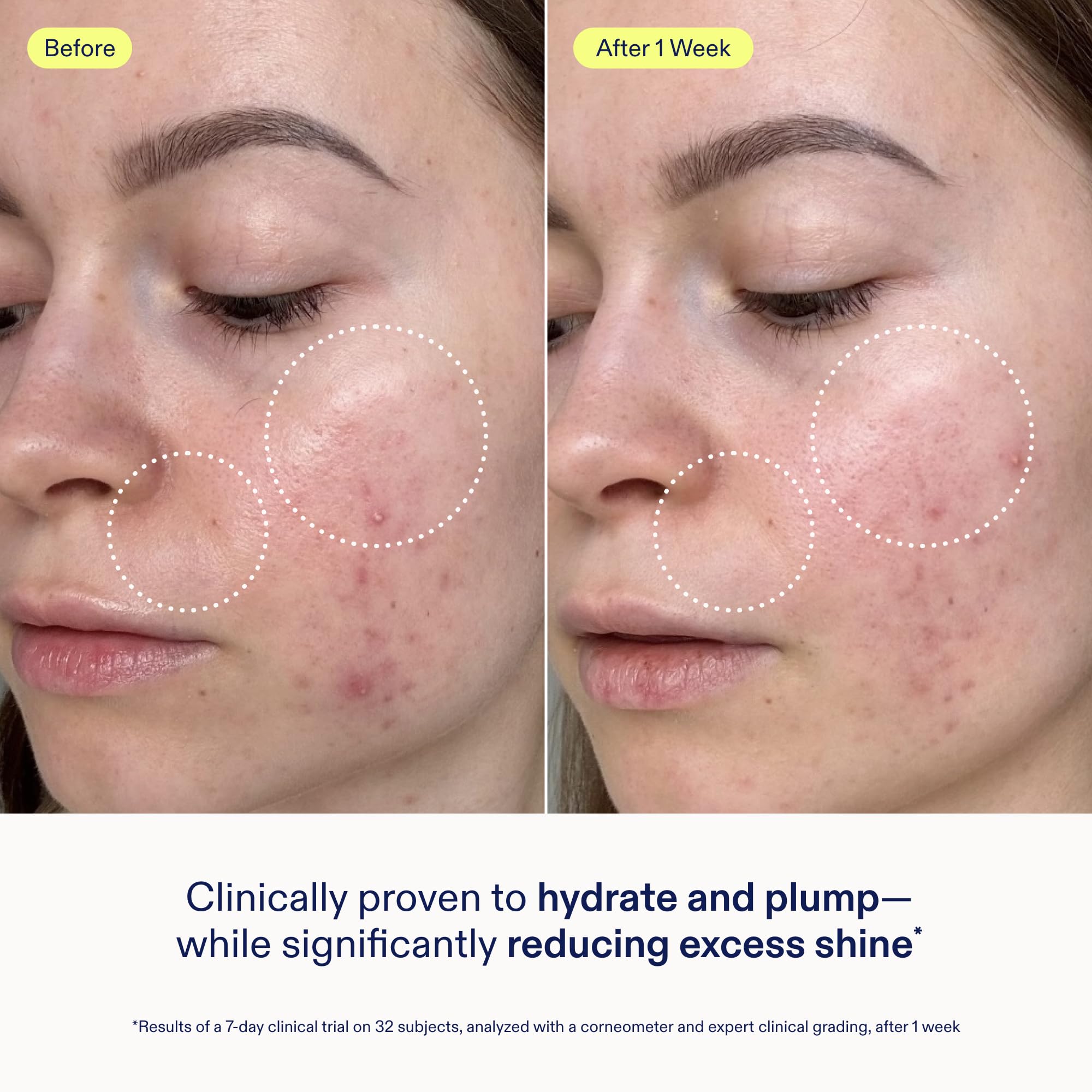 Skinfix Skin Barrier Gel Cream ingredients featuring 3% lipid complex for barrier support