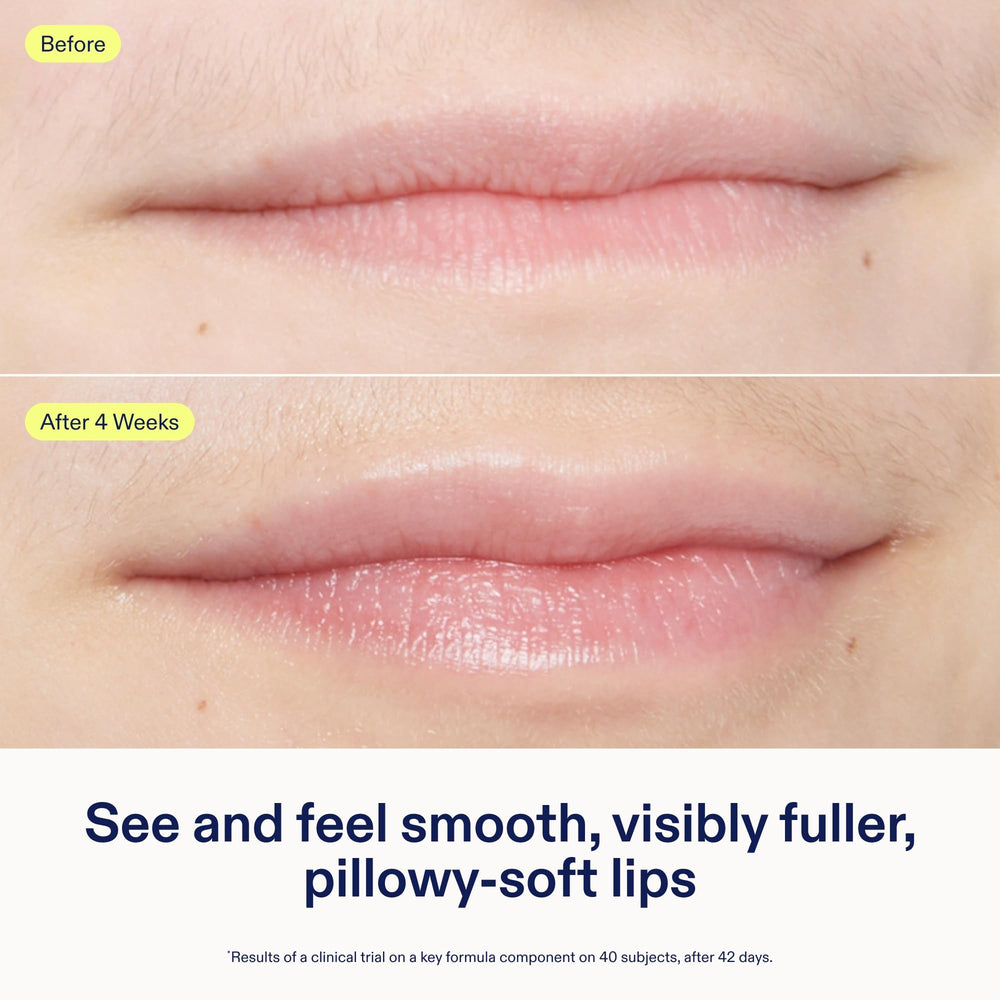 Skinfix Triple Lipid Lip Treatment lips close-up suggests pillow-soft fullness