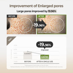Skinfood 1957 Pore care pad in use on cheek