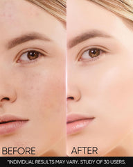 SKINTIFIC MSH Cream spread on skin shows smooth, non-greasy finish