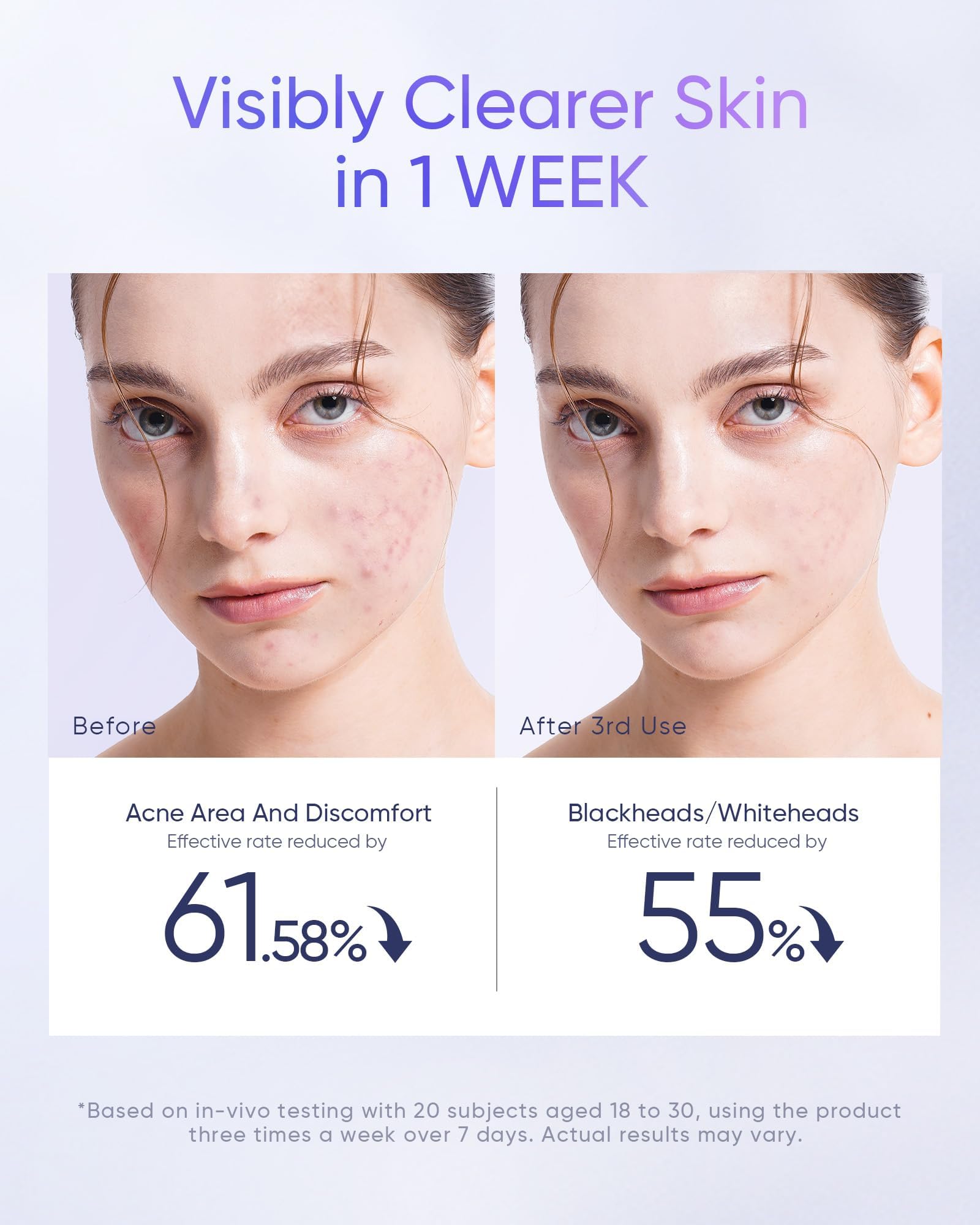 SKINTIFIC Pads for oily acne-prone skin closeup suggesting balanced exfoliation