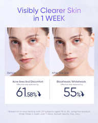 SKINTIFIC Pads for oily acne-prone skin closeup suggesting balanced exfoliation