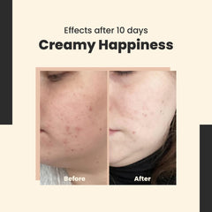 Cream spread demonstrates smooth application and a soft matte finish on the skin.