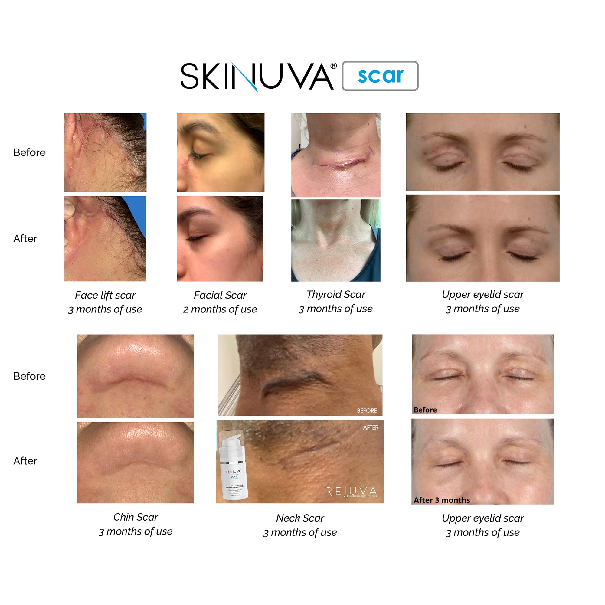 Skinuva application directions for twice-daily use morning and night.