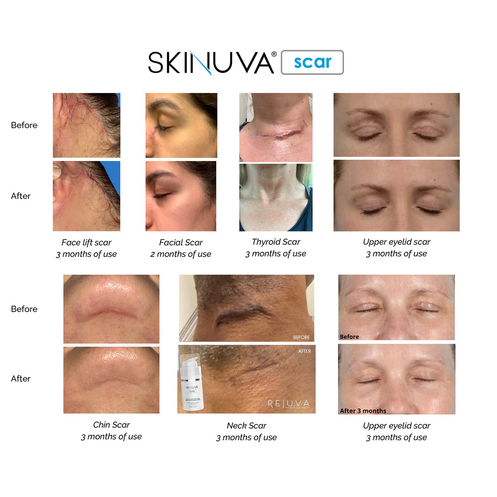 Skinuva application directions for twice-daily use morning and night.