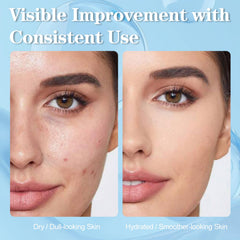 SKSOYT Hyaluronic acid serum texture highlighting hydration boost.