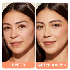 SKSOYT Triple Power skin radiance close-up suggesting healthy, glowing complexion.