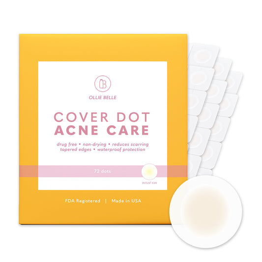 SMARTMED Cover Dot Acne Care patch on skin, nearly invisible for daytime use