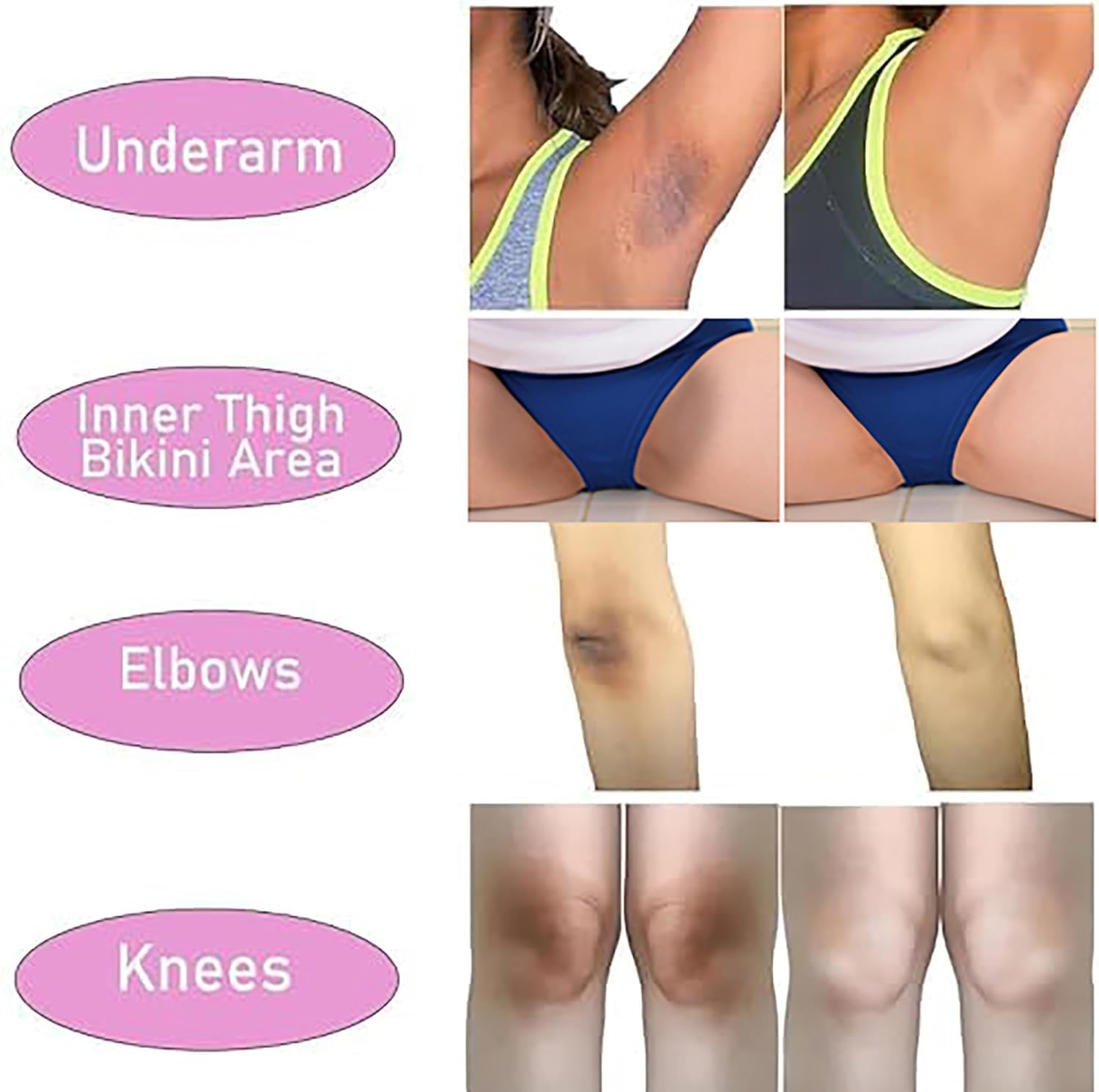 SMILEFACE private-parts-cream-application shows smooth non-sticky finish for comfortable wear.