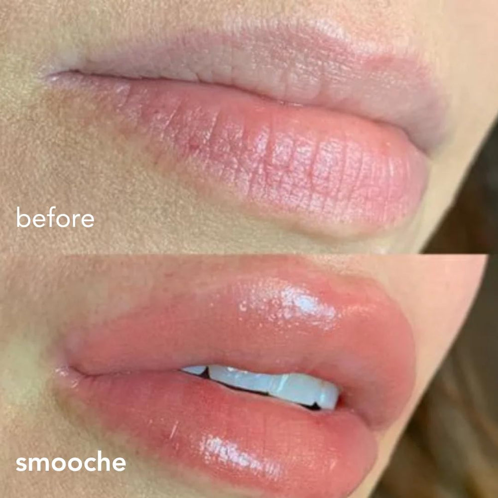 Smooche lip plumper glossy lips image highlights rich shine and enhanced volume.