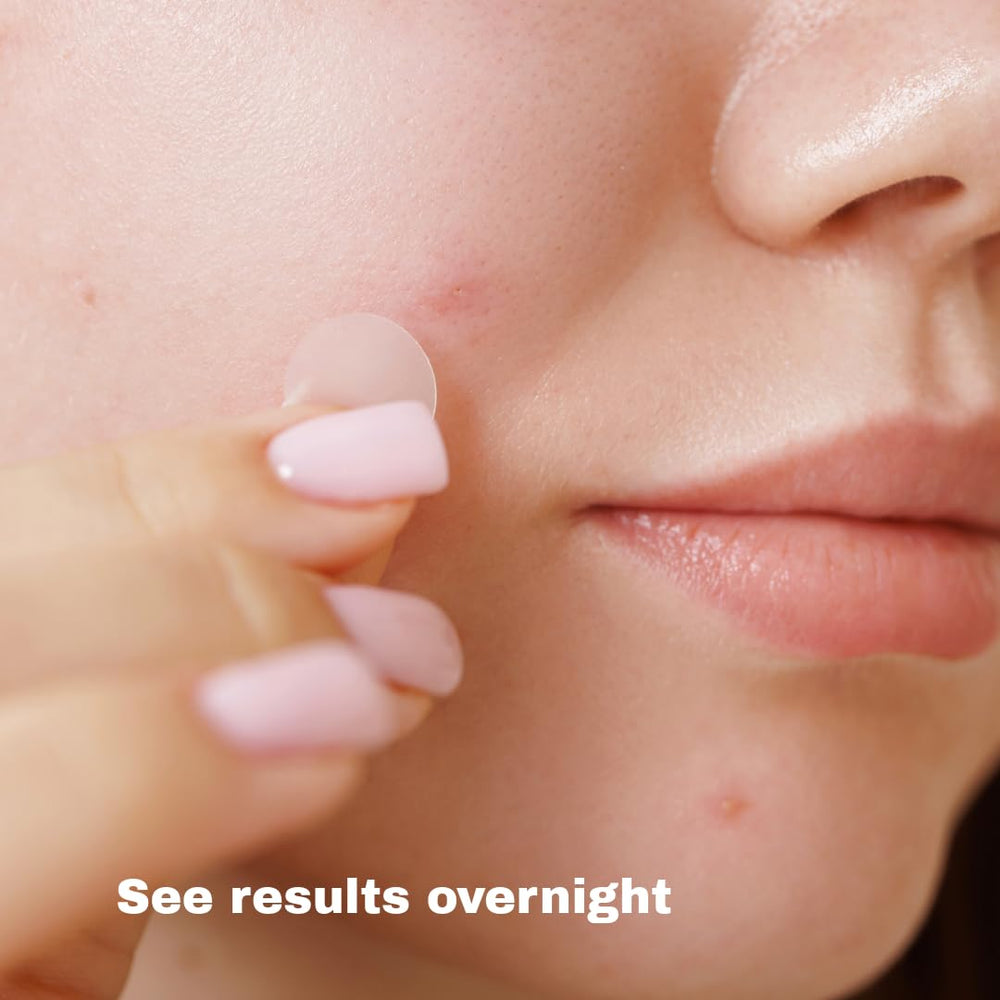 Snappios Skin care routine with patches for on-the-go care