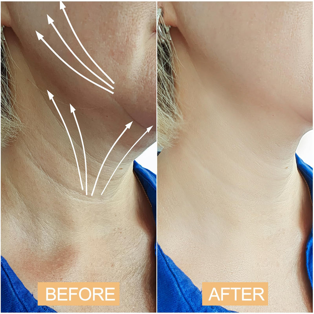 Close-up of Snifflink neck lifting tape showing skin-friendly adhesive and thin profile.