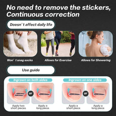 SOAOP three-size set (0.59–0.79 in) to fit every toe.