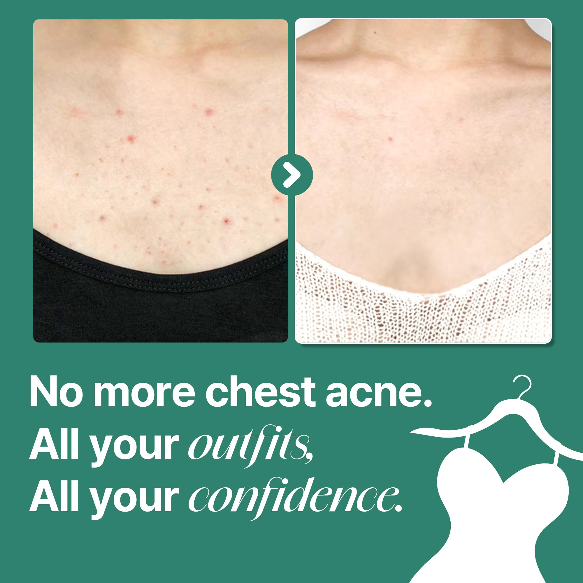 SOME BY MI Miracle Body Cleanser texture close-up reveals micro-bubble cleansing action