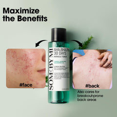 Some By Mi pore care toner embossed label communicates daily exfoliation benefits.