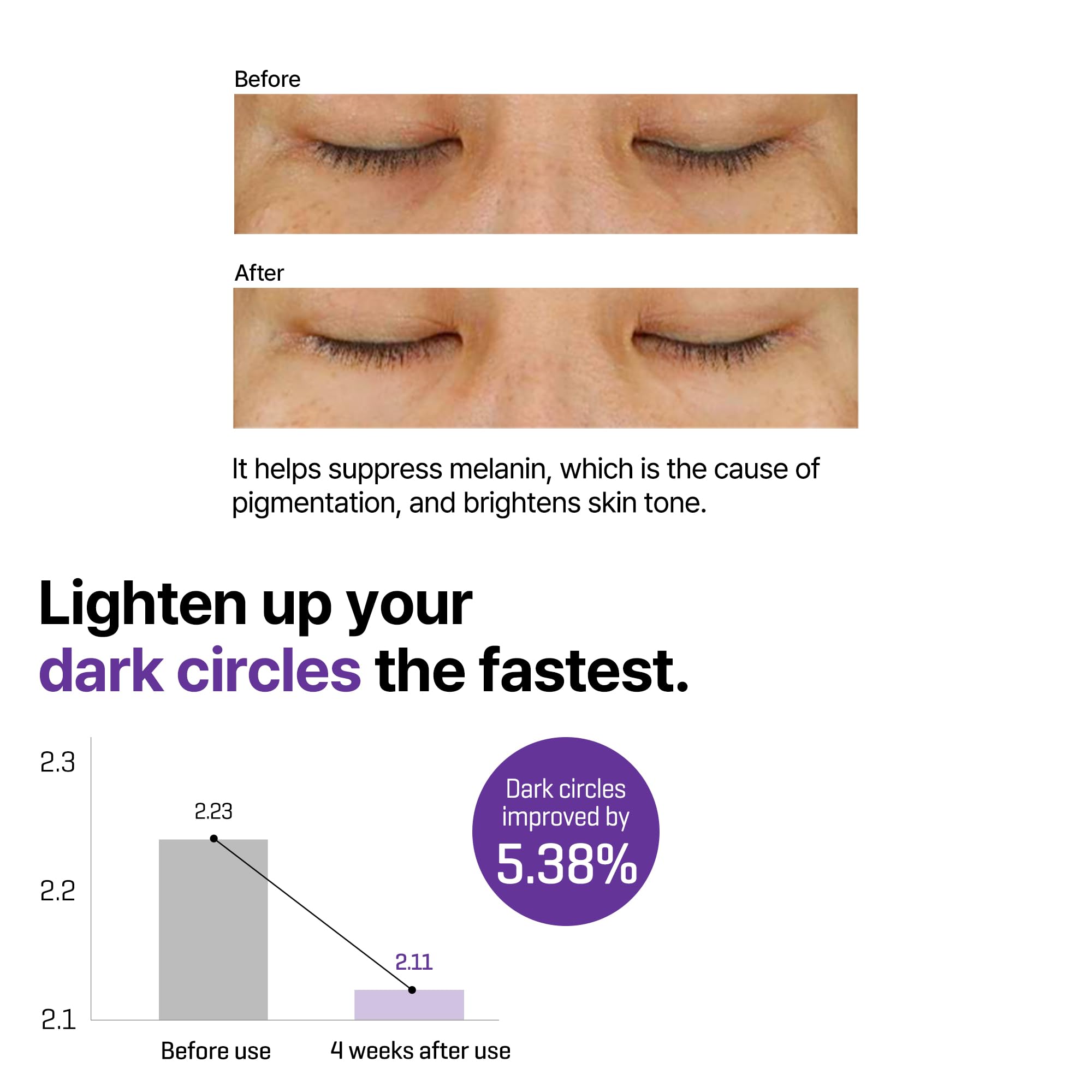 SOME BY MI eye cream under-eye application demonstrating gentle use