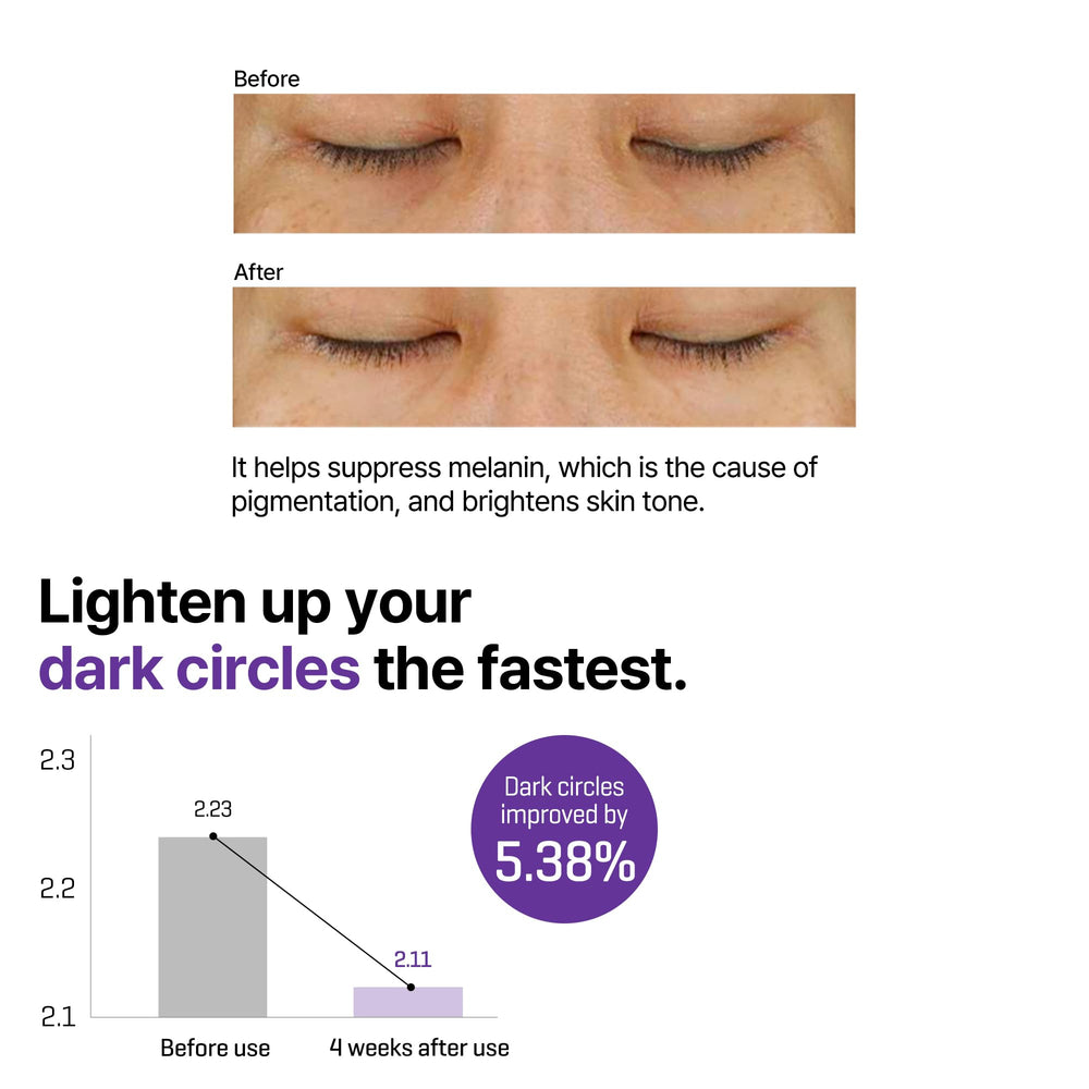SOME BY MI eye cream under-eye application demonstrating gentle use