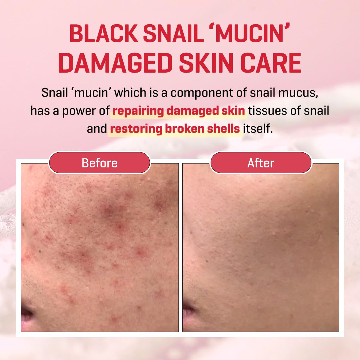 Snail mucin and Truecica ingredients close-up in SOME BY MI serum