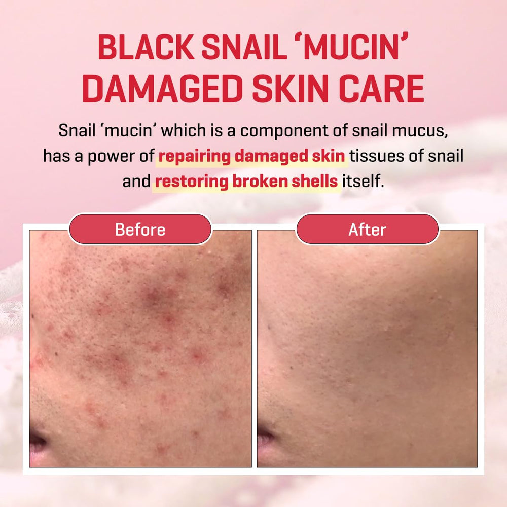 Snail mucin and Truecica ingredients close-up in SOME BY MI serum