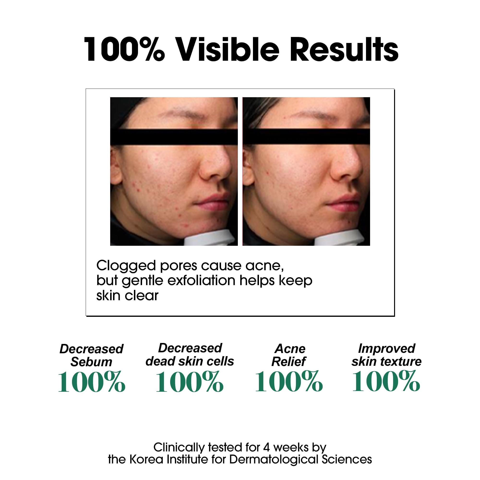Some By Mi Tea Tree leaf closeup indicates calming spot care potential.