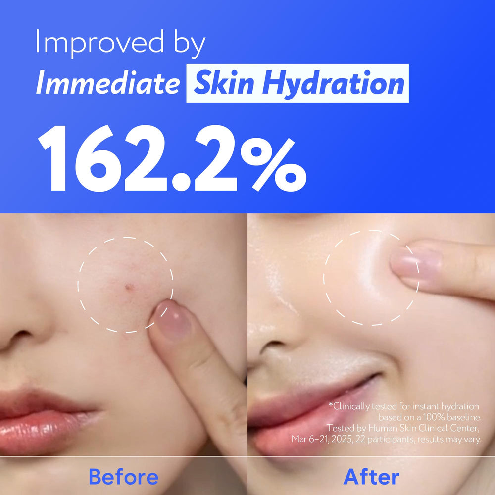 Centella asiatica focus helps calm redness and irritation.