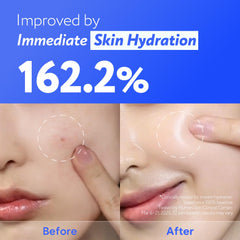 Centella asiatica focus helps calm redness and irritation.