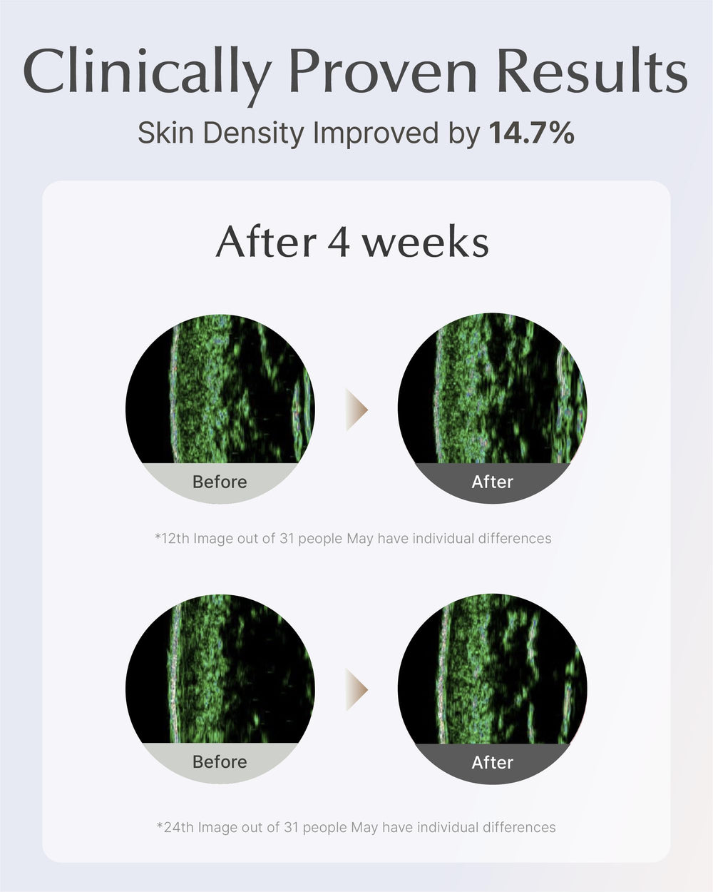 Sooryehan Lifting Ampoule Serum with 5% Niacinamide supports even skin tone