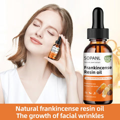 SOPANL ingredients close-up showing frankincense for soothing properties