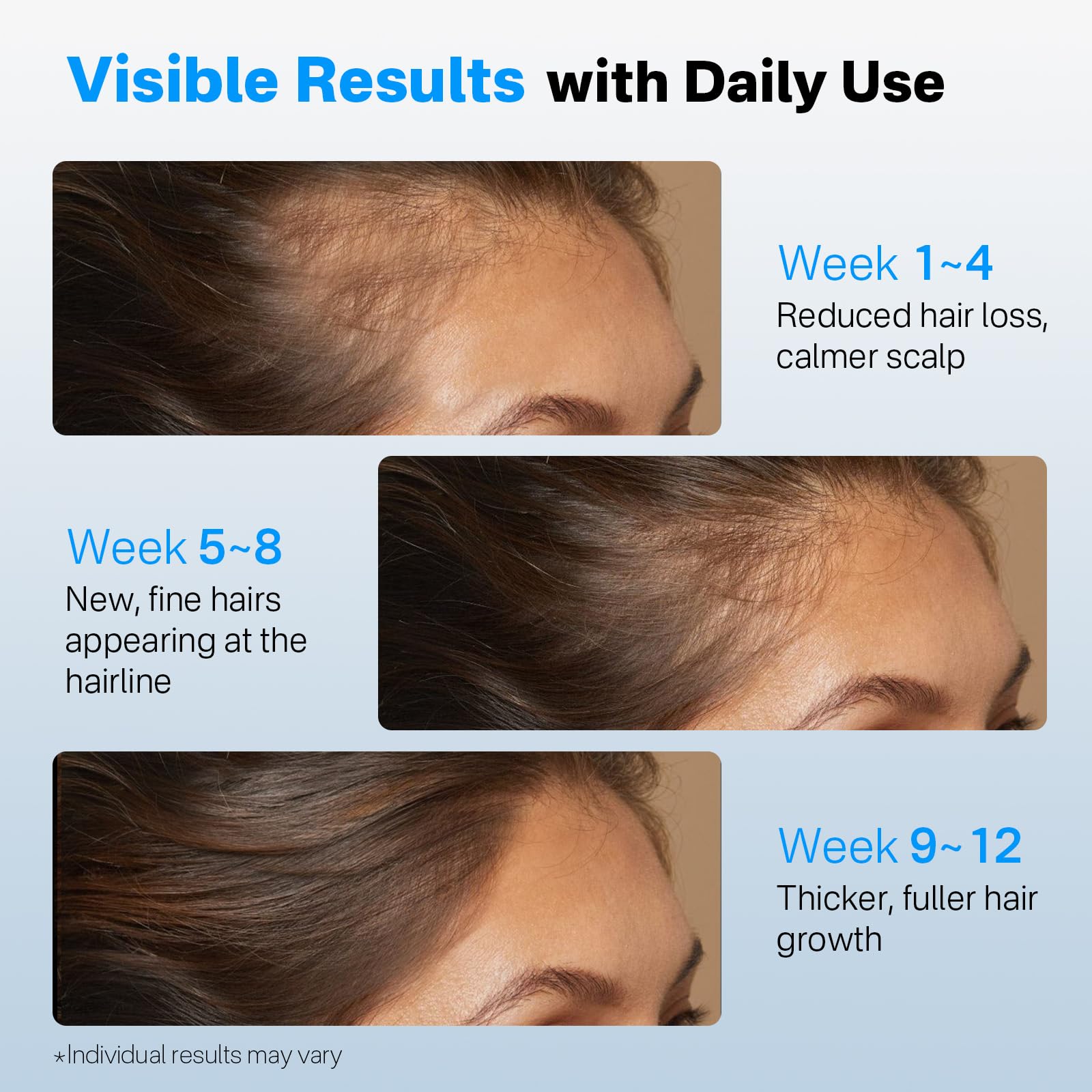 SORNBEO saw palmetto action promoting scalp balance