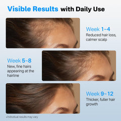 SORNBEO saw palmetto action promoting scalp balance
