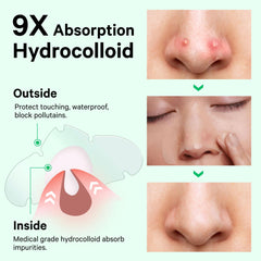 Sosky Nose Patch 4-hour action demonstrates quick pore clarity
