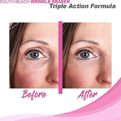 South Beach Salon Strength sun-damage repair on sun-exposed skin