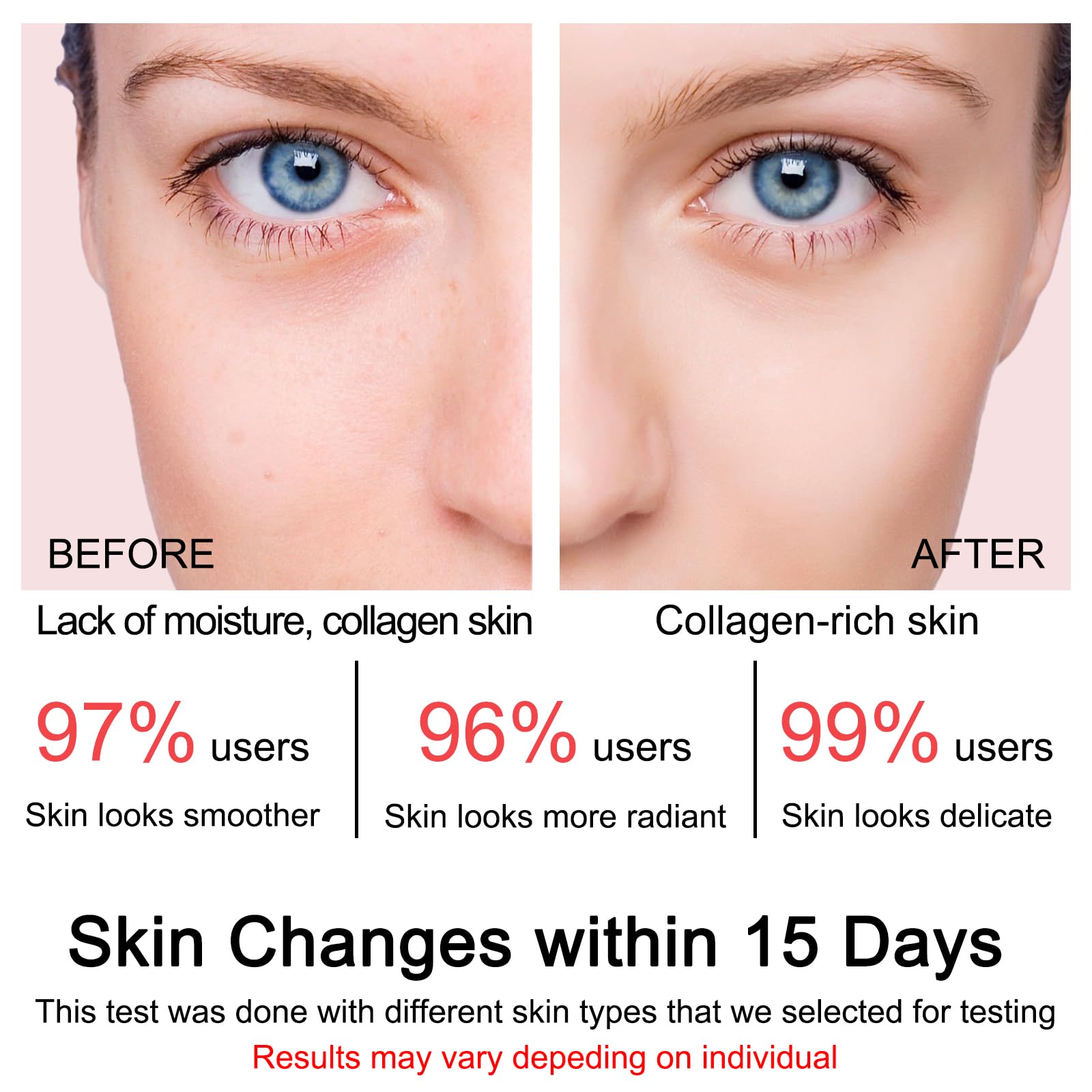 SOYUB Collagen Jelly Cream night use image suggests overnight nourishment