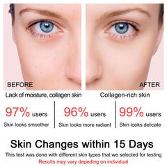 SOYUB Collagen Jelly Cream night use image suggests overnight nourishment