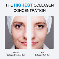 SOYUB Collagen Mask during 2-hour wear shows absorption progress.