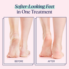 SpaLife Moisturizing Foot Sockies cream texture absorbing into dry skin