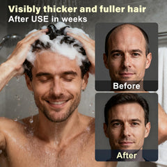 SPARTAN HAIR Root Activator Shampoo with pump for easy daily use