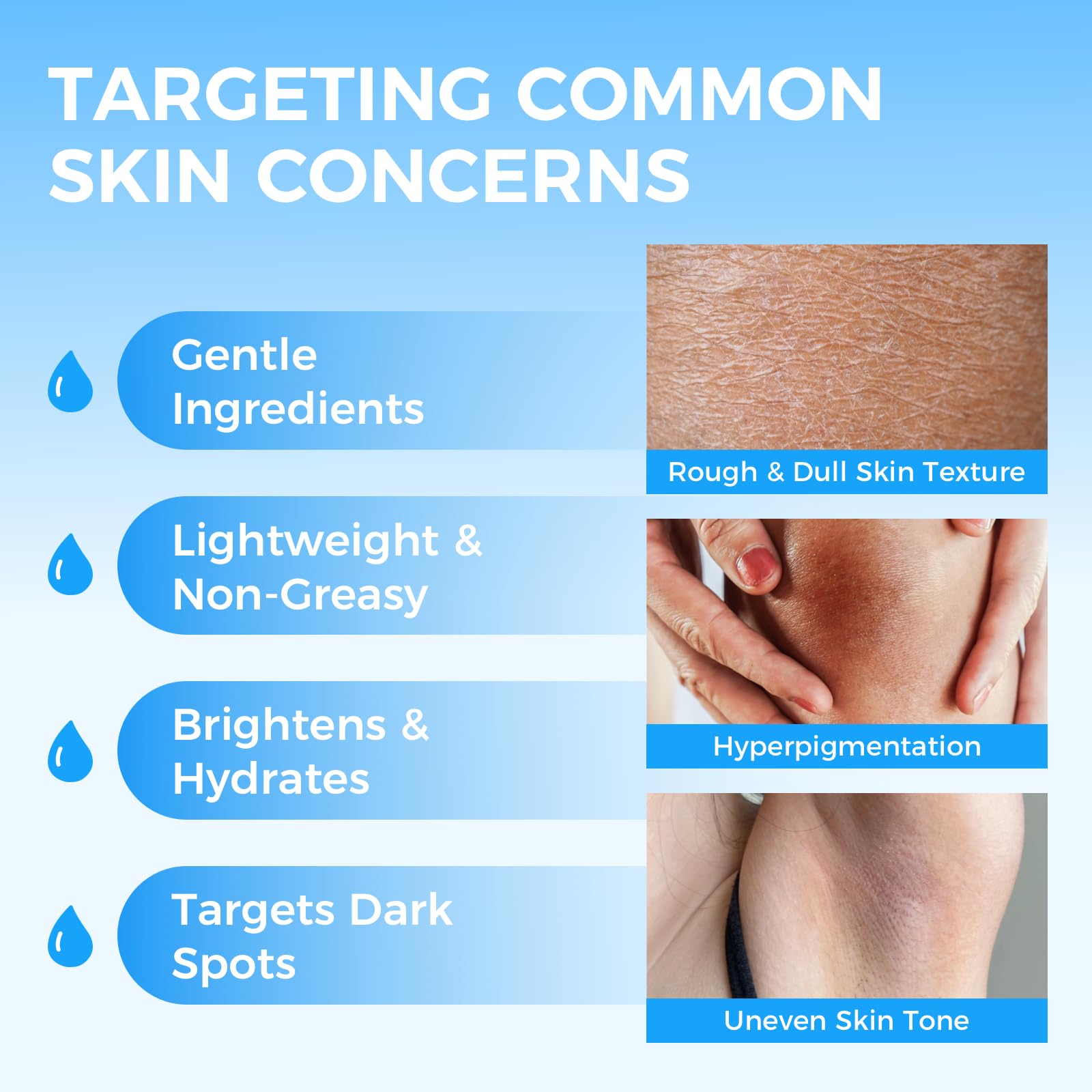 Sperandi dark spot remover bikini line for even tone in sensitive areas.