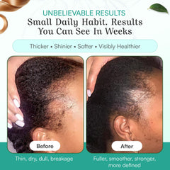 Spoild Batana Oil use – massage into scalp, wait 20 minutes, rinse.