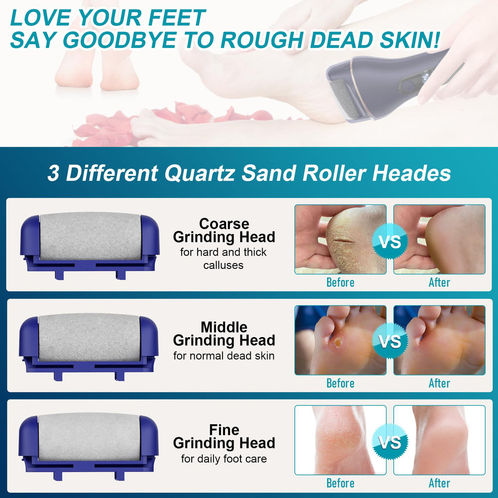 Spriak foot file LCD display shows speed and power