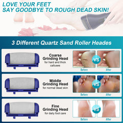 Spriak foot file LCD display shows speed and power