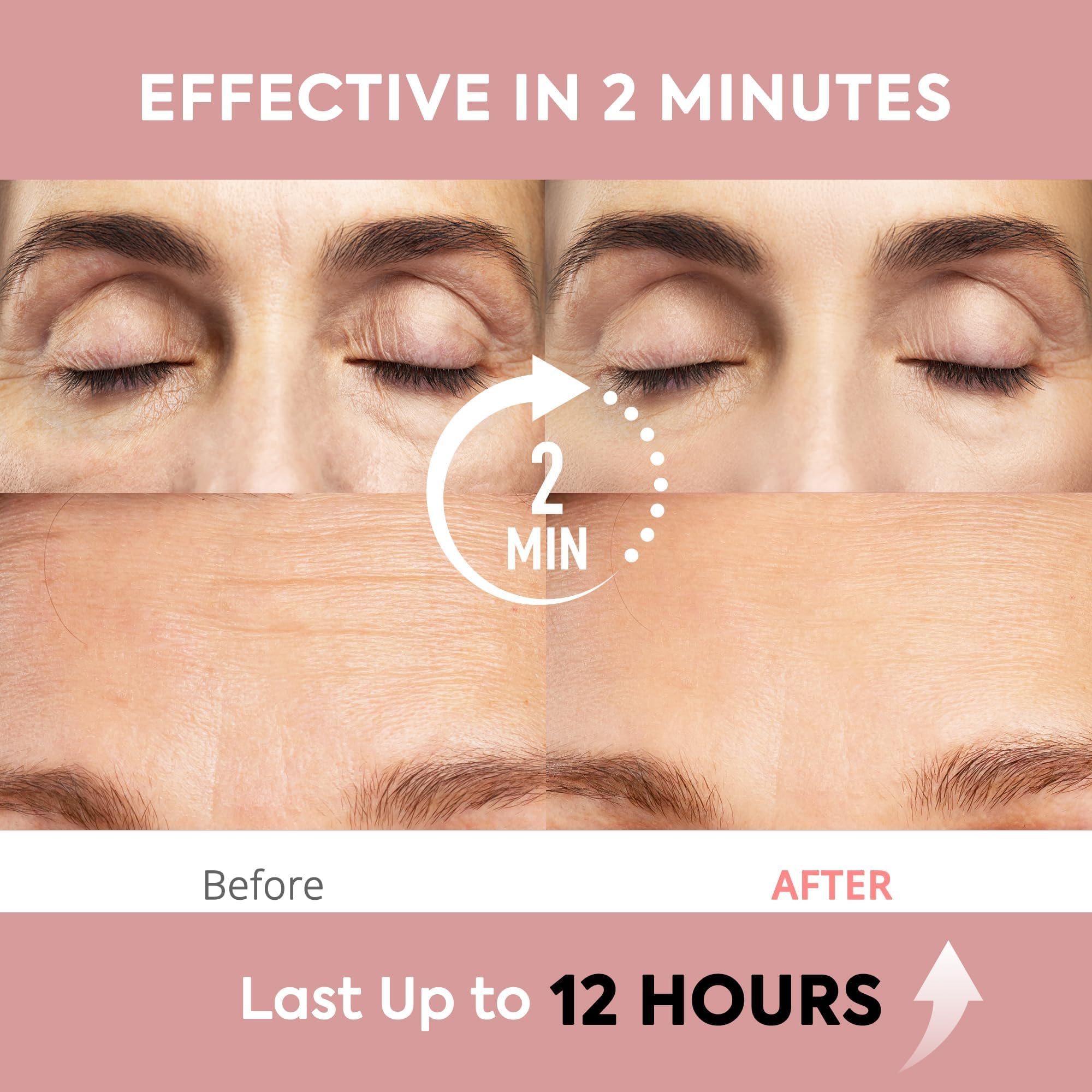 St. Mege Instant Eye and Face Lift Cream under-eye area reducing puffiness for refreshed look