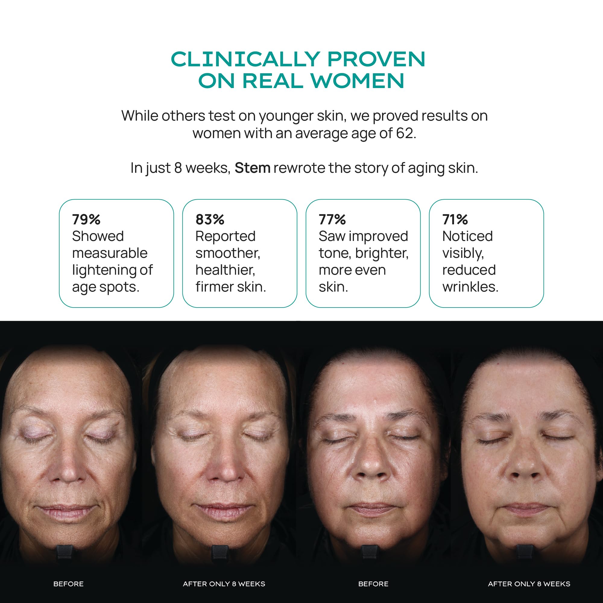 STEM Natural Intelligence Revitalize Night Cream ingredients panel notes niacinamide and stem cells