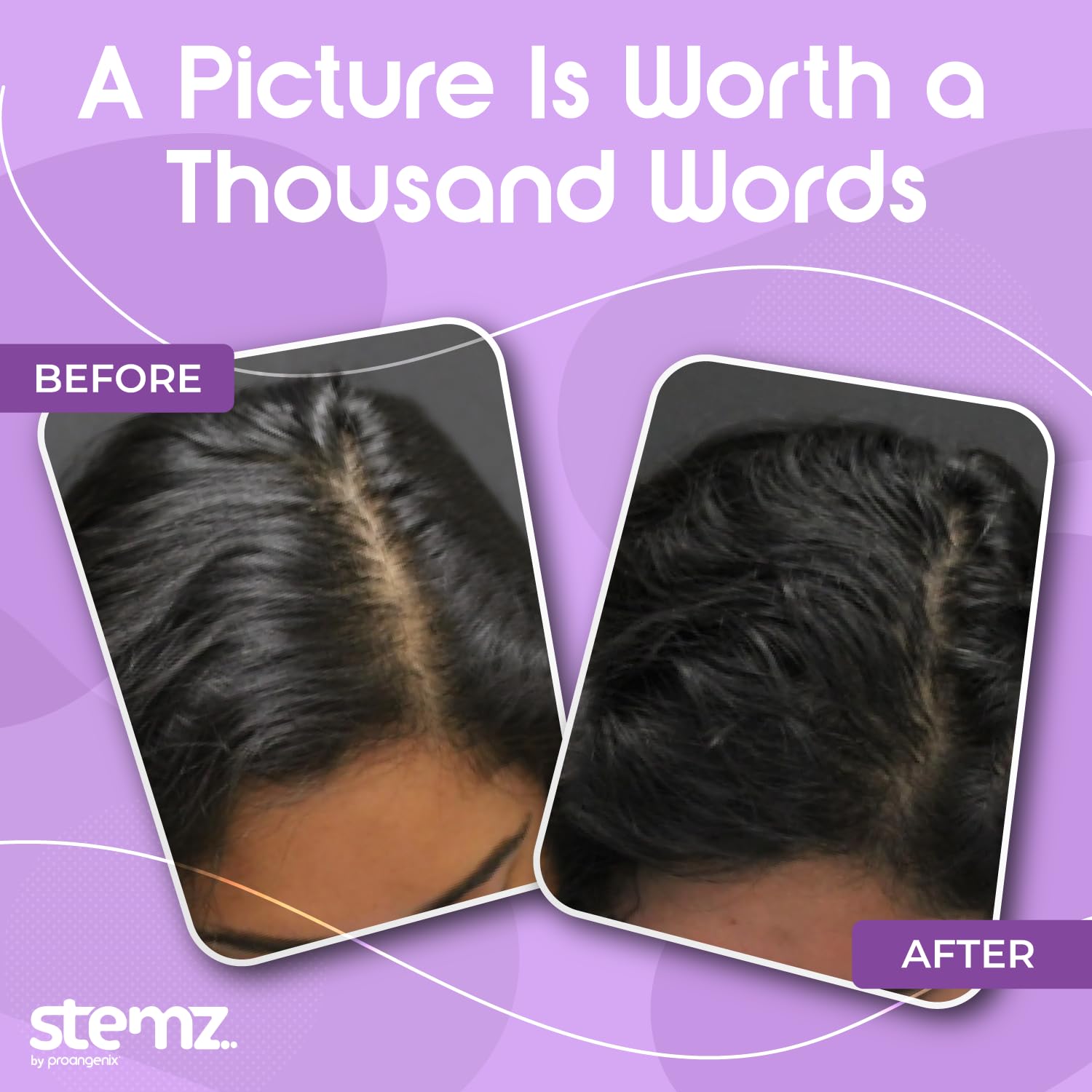 Stemz by Proangenix fast-absorption texture indicates quick, non-greasy application.