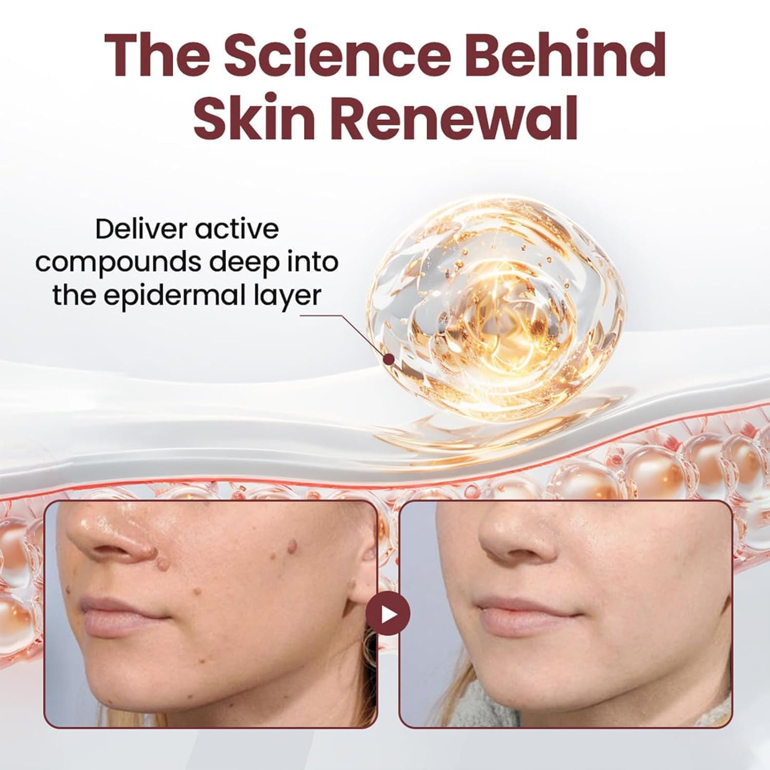 STIEKIET professional skin-treatment pack shown for salon-like results