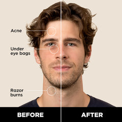 Stryx Concealer Stick being dabbed on the face for natural coverage