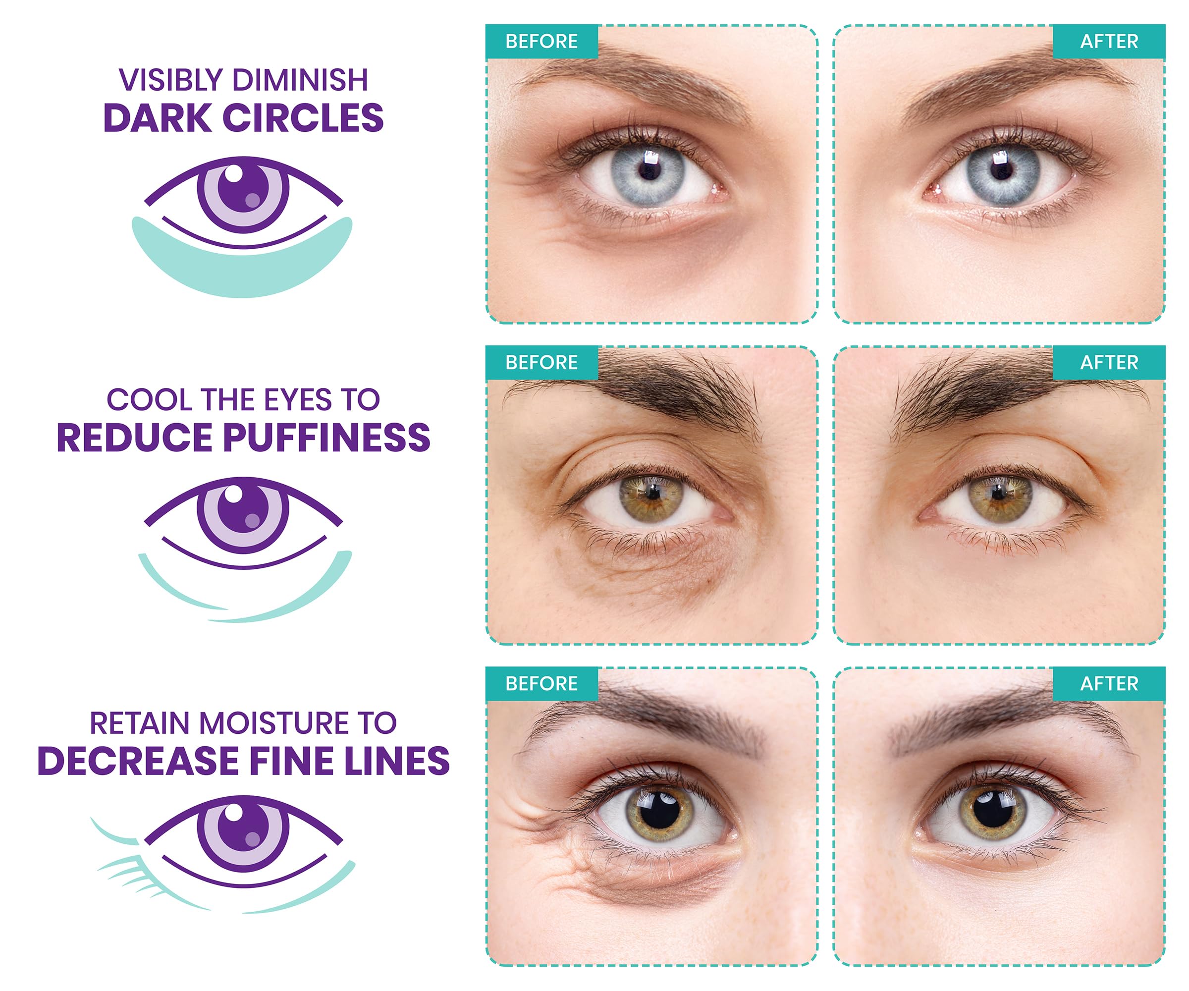 Stylia under eye patches retinol formula for a brighter under-eye appearance.