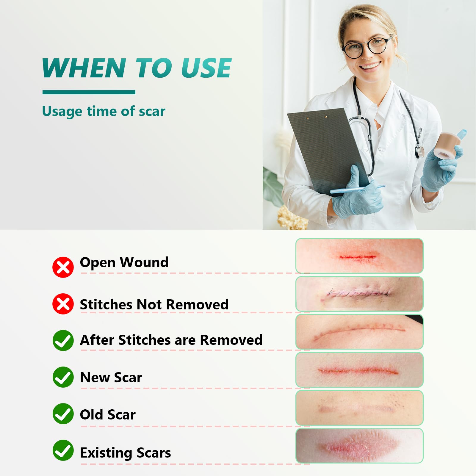 SUCONBE silicone scar tape may help improve texture over time on a scar