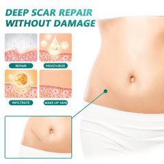 SUCONBE silicone scar tape waterproof design protecting scar area during daily activities